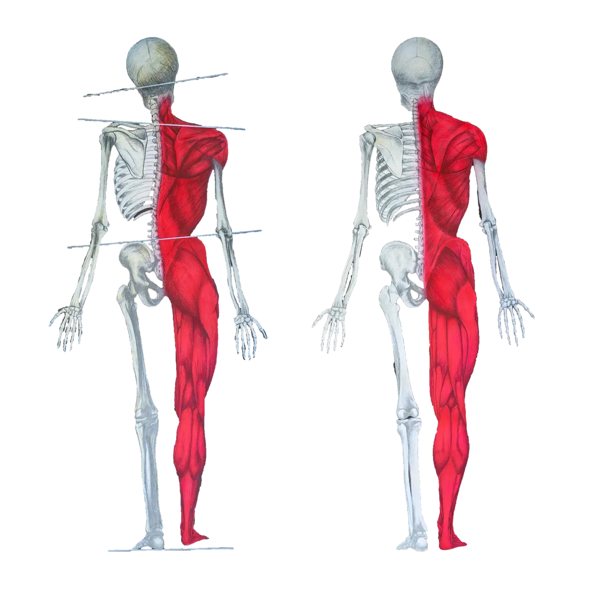 Two anatomical illustrations of the human back. The left figure shows a skeleton with red muscles on its right side and tilted horizontal lines indicating postural imbalance. The right figure shows a similar skeleton with red muscles on its right side, but in a more aligned posture.
